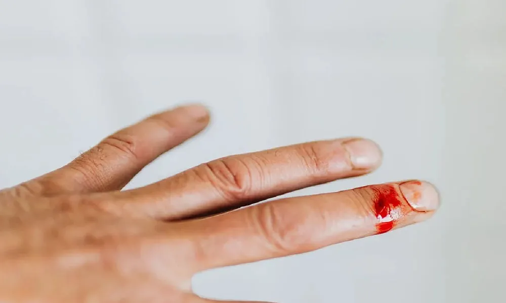 5 Common Fencing Injuries and How to Avoid Them